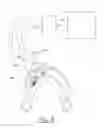 Fig. 07 - Intraoral device for automated preparation of the teeth with a view to performing partial or peripheral restorations
