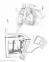 Fig. 02 - Dental devices and methods for treating one or more teeth