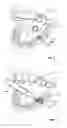 Fig. 04 - Dental devices and methods for treating one or more teeth