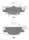 Fig. 02 - Dental matrix band