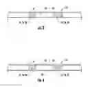 Fig. 03 - Dental matrix band