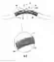 Fig. 04 - Dental matrix band