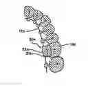 Fig. 01 - Customized orthodontic appliance and method