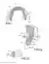 Fig. 02 - Customized orthodontic appliance and method