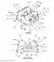 Fig. 06 - Customized orthodontic appliance and method