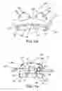 Fig. 07 - Customized orthodontic appliance and method