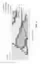 Fig. 02 - Vibrating orthodontic strip