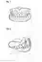 Fig. 02 - Apparatus and methods of making denture devices