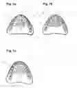Fig. 06 - Apparatus and methods of making denture devices