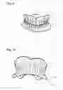 Fig. 08 - Apparatus and methods of making denture devices