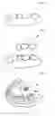 Fig. 02 - DENTAL PROSTHESIS AND ITS MANUFACTURING METHOD