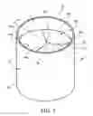 Fig. 02 - Prosthetic heart valve formation