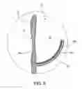 Fig. 08 - Prosthetic heart valve formation