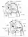 Fig. 06 - Devices, systems, and methods for reshaping a heart valve annulus