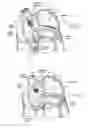 Fig. 09 - Devices, systems, and methods for reshaping a heart valve annulus