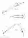 Fig. 22 - Devices, systems, and methods for reshaping a heart valve annulus