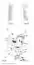 Fig. 02 - Condylar prosthesis for a temporo-mandibular joint