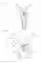 Fig. 02 - Artificial hip joint stem, stem inserter, artificial hip joint system including them, and artificial hip joint