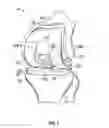 Fig. 02 - Femoral component for bone conservation