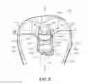 Fig. 06 - Knee prosthesis