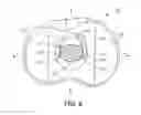Fig. 09 - Knee prosthesis