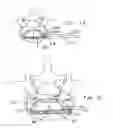 Fig. 09 - Laterally deflectable implant