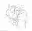 Fig. 01 - Bone preserving intraoperative downsizing system for orthopaedic implants