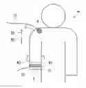 Fig. 01 - Electrically powered artificial hand