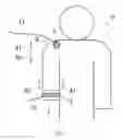 Fig. 02 - Electrically powered artificial hand