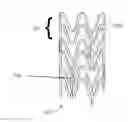 Fig. 01 - Method of treatment with a bioabsorbable stent with time dependent structure and properties and regio-selective degradation