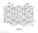 Fig. 08 - Method of treatment with a bioabsorbable stent with time dependent structure and properties and regio-selective degradation