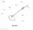 Fig. 41 - METHODS AND DEVICES FOR  REDUCING GASTRIC VOLUME