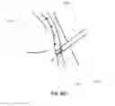 Fig. 43 - METHODS AND DEVICES FOR  REDUCING GASTRIC VOLUME
