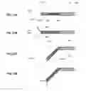 Fig. 44 - METHODS AND DEVICES FOR  REDUCING GASTRIC VOLUME