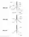 Fig. 52 - METHODS AND DEVICES FOR  REDUCING GASTRIC VOLUME