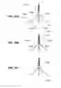 Fig. 53 - METHODS AND DEVICES FOR  REDUCING GASTRIC VOLUME