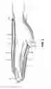 Fig. 03 - Therapeutic Gloves with Heating Pads