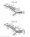 Fig. 10 - Pull-on wearing article