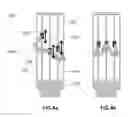 Fig. 07 - A Mobile Robotic Lifting and Transferring System for Bariatric Patients