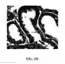 Fig. 09 - Materials and methods for treating diseases caused by genetic disorders using aminoglycosides and derivatives thereof which exhibit low nephrotoxicity