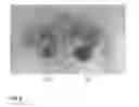 Fig. 09 - Composition comprising extract or compound derived therefrom as active ingredient for preventing and treating benign prostatic hyperplasia