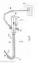 Fig. 02 - High pressure delivery system and method for treating pelvic disorder using large molecule therapeutics