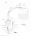 Fig. 02 - Inductive element for providing MRI compatibility in an implantable  medical device lead