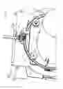 Fig. 06 - Pipe conditioning tool