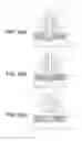 Fig. 04 - Process for spot-joining stacked metal foils