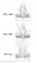 Fig. 08 - Process for spot-joining stacked metal foils