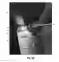 Fig. 04 - Verification Of Pharmaceutical Product Packaging To Prevent Counterfeits, Using Hidden Security Features Revealed With A Laser Pointer