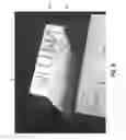 Fig. 07 - Verification Of Pharmaceutical Product Packaging To Prevent Counterfeits, Using Hidden Security Features Revealed With A Laser Pointer