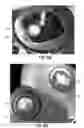Fig. 10 - Verification Of Pharmaceutical Product Packaging To Prevent Counterfeits, Using Hidden Security Features Revealed With A Laser Pointer