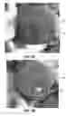 Fig. 13 - Verification Of Pharmaceutical Product Packaging To Prevent Counterfeits, Using Hidden Security Features Revealed With A Laser Pointer